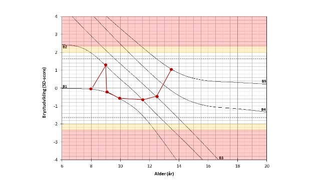 Eksempel på normal brystudvikling